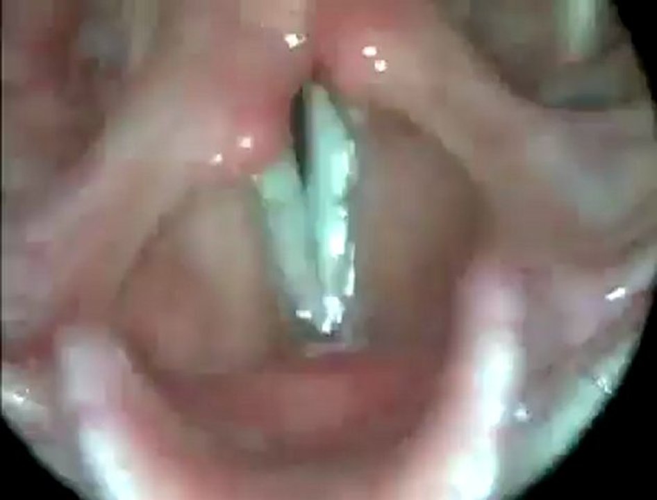 cordes vocales en action !