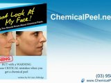 Chemical Peels: Shouldn't My Skin Peel After A Chemical Pee