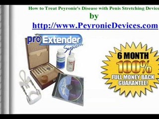 How to Treat Peyronie's Disease with Stretching Device