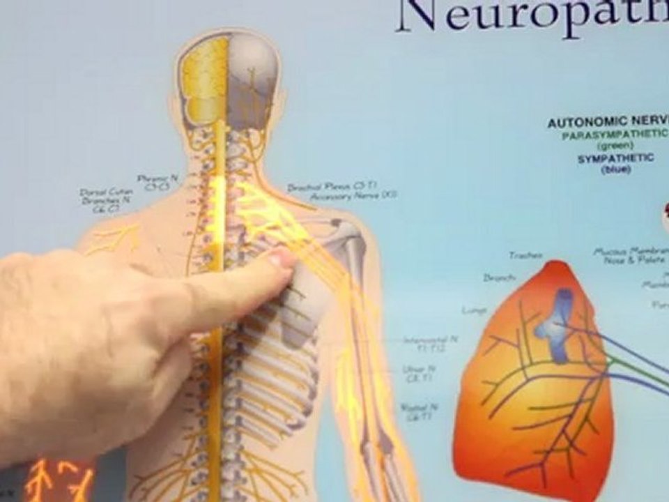 Chesapeake, VA Precision Spinal Care - Shoulder and Arm Pain