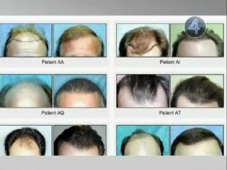 Mondo 2 Game Overview