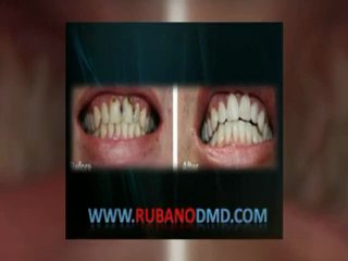 terrific smiles of the palm beaches