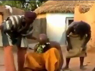 Afrika usulü Migren tedavisi