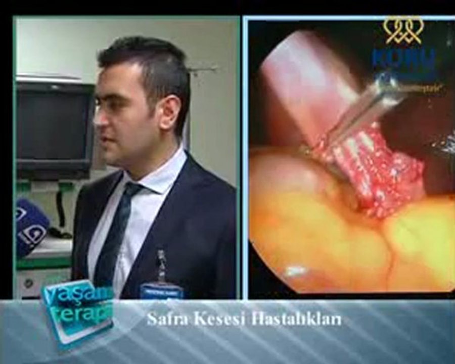 Safra kesesi hastalıkları ve açık kapalı ameliyatları (koruhastanesi.com)