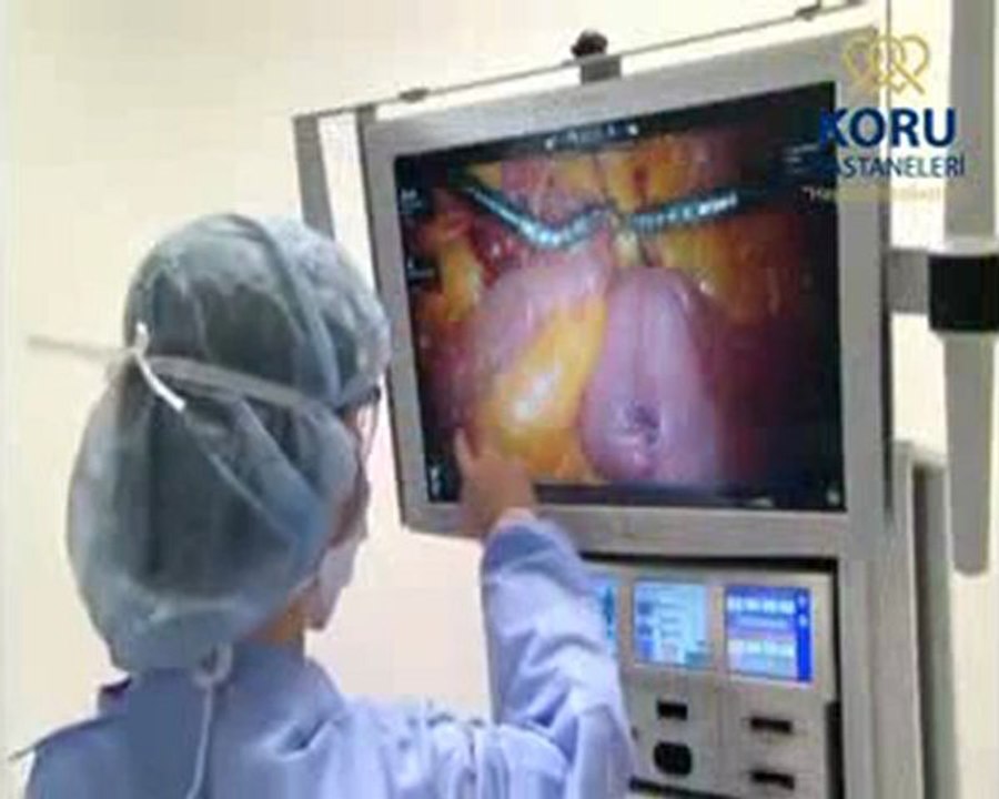 Robotik Cerrahi Merkezi - Robotik Cerrahi Sistemi - Koru Hastanesi