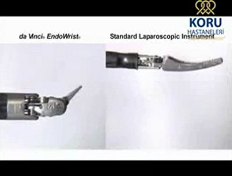 da Vinci Robotik Cerrahi Merkezi Koru Hastanesi +90-312-287-9797.