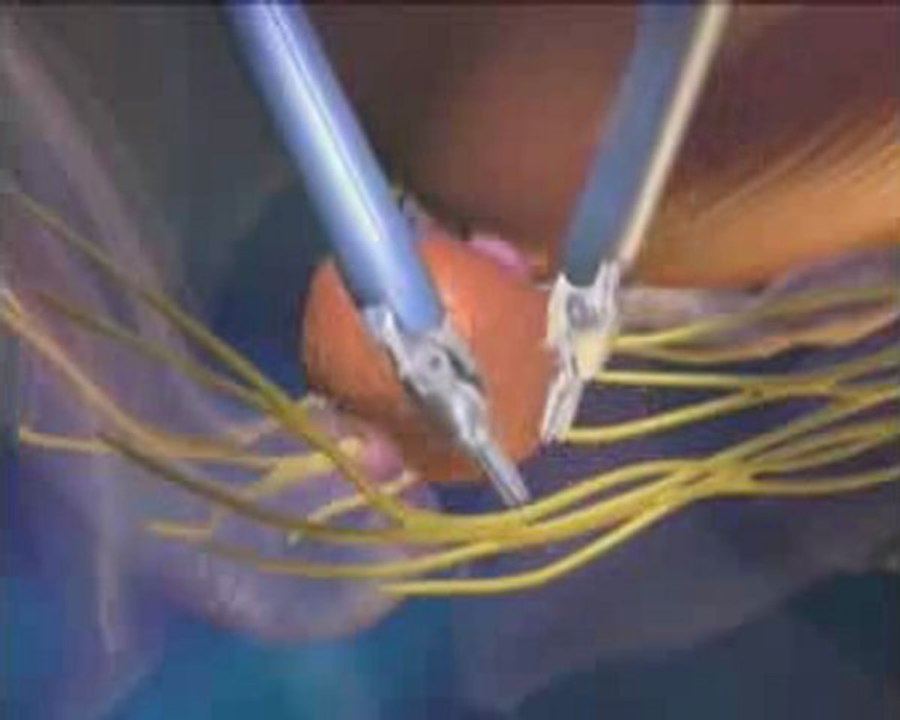 Robotik Cerrahi Merkez - Koru Hastanesi +90-312-287-9797