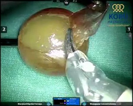 Robotik Cerrahi Merkezi - Koru Hastanesi +90-312-287-9797