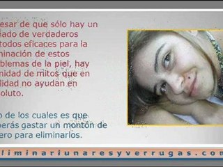 Remover lunares y verrugas