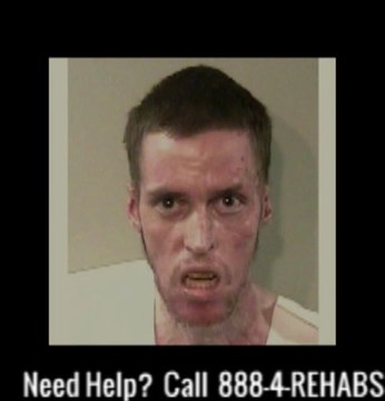 Avant / Après : visages de drogués à la Méthamphetamine