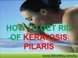 How To Get Rid Of Keratosis Pilaris