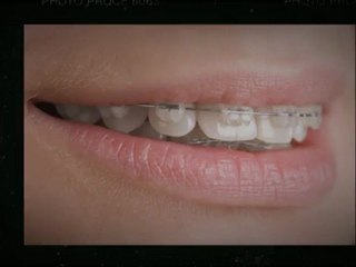 Port Moody Orthodontist Sept2012