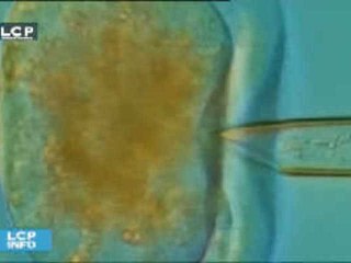 Reportages : Bioéthique : vers le transfert post-mortem des embryons ?