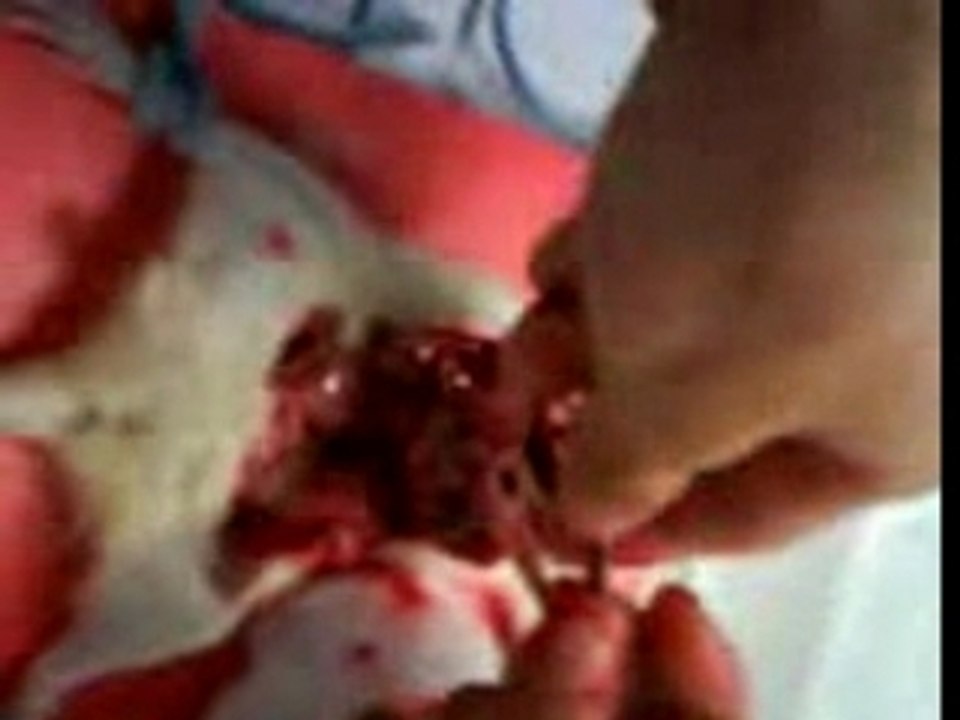 vivissection