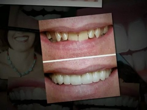 Cosmetic Dentistry In Folsom Ca. 916-817-6453