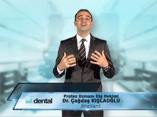 İmplant Tedavi Süreçleri Nedir -  İmplant Nasıl Yapılır