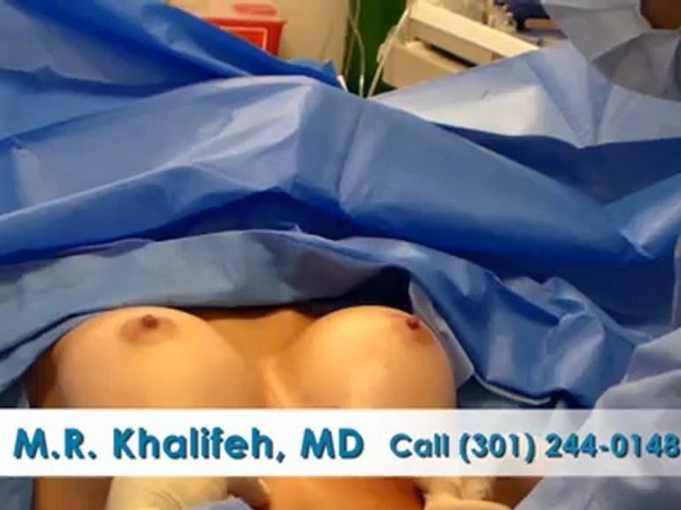 BreastAugmentation
