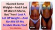 How To Get Rid Of Stretch Marks Naturally