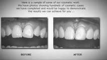 Dentists Implants Orange Veneers Dentures Cosmetic Dentistry Invisalign Dental Services