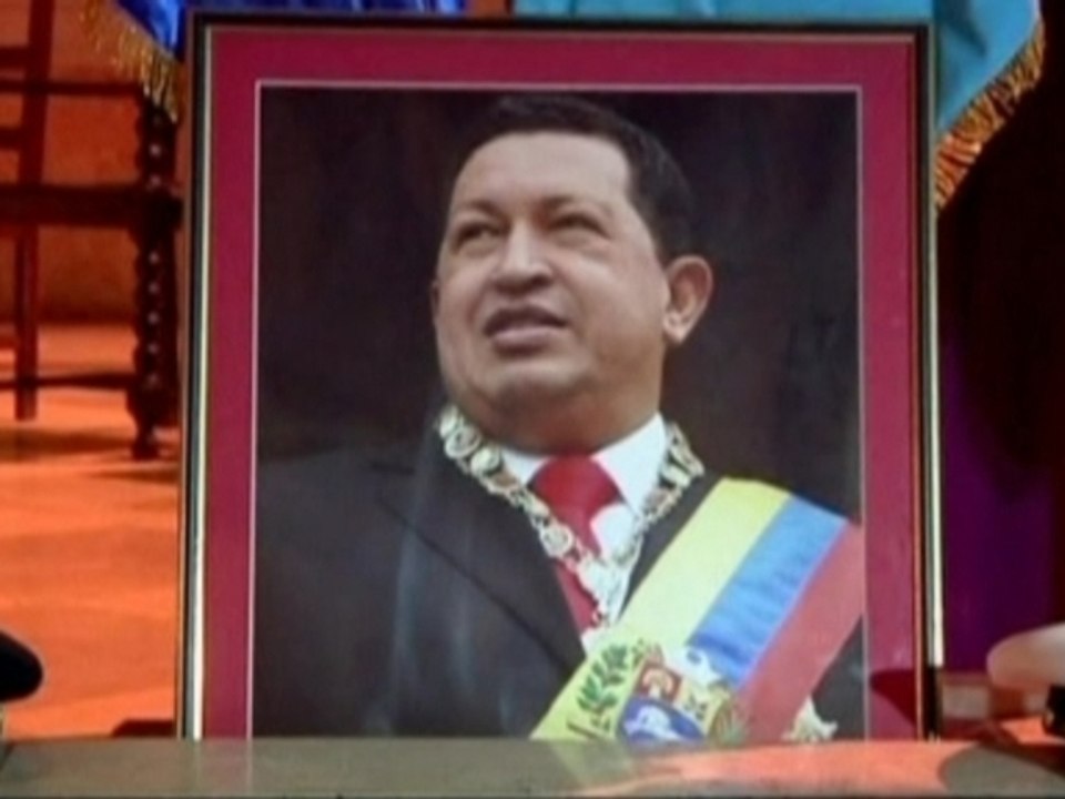 Chavez's condition inproving in hospital