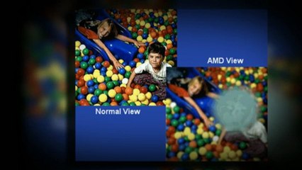 Treatment of Cataracts