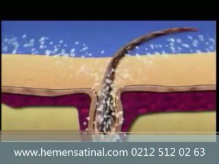 Saçlar Neden Dökülür?