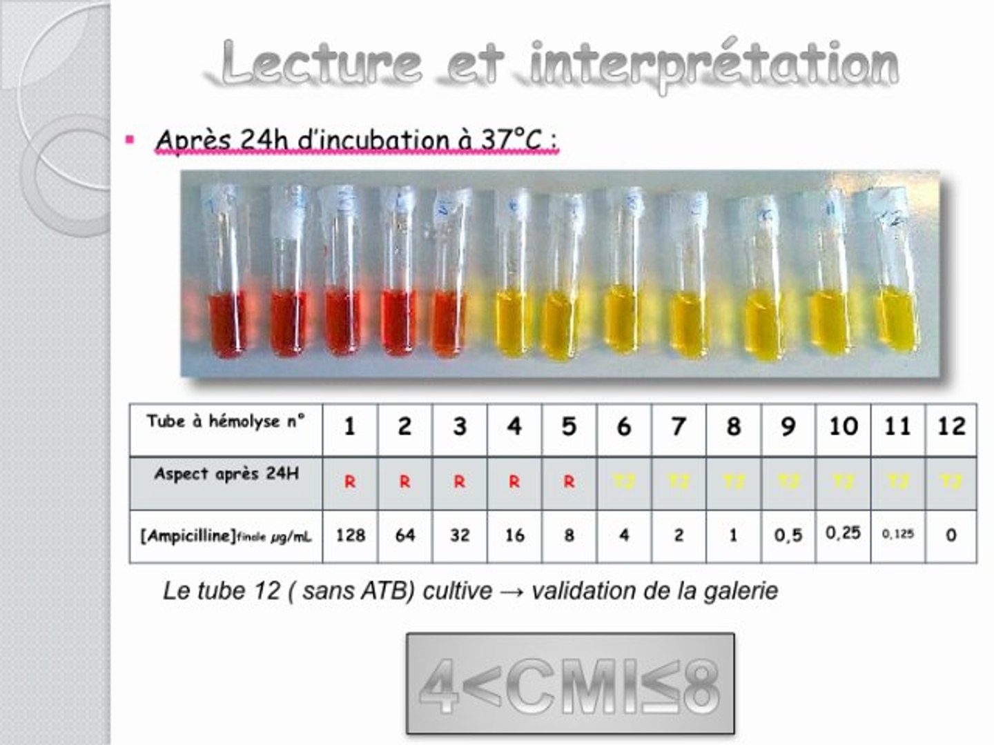 Quelle Est La Différence Entre Antibiogramme Et Cmi – ZDMD
