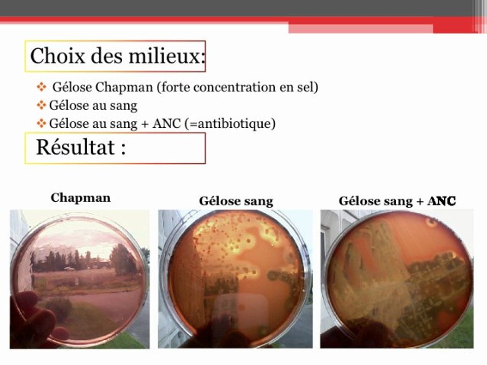 Recherche d'une infection chez un patient