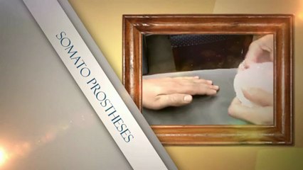 Prosthetic Impressions