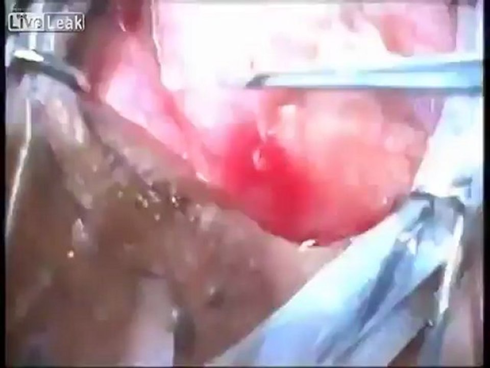 Göz paraziti Mediser Medikal