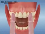 Özel evrensel diş sağlığı kliniği evrenselimplant.com