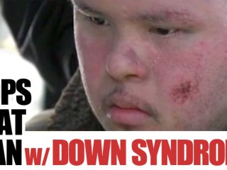 Cops Pepper Spray and Beat Man w/ Down Syndrome