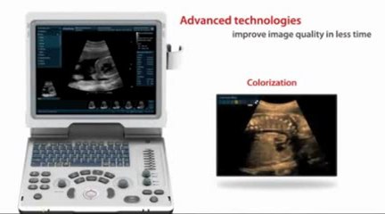 Mindray DP50 ( Medical Device Depot )