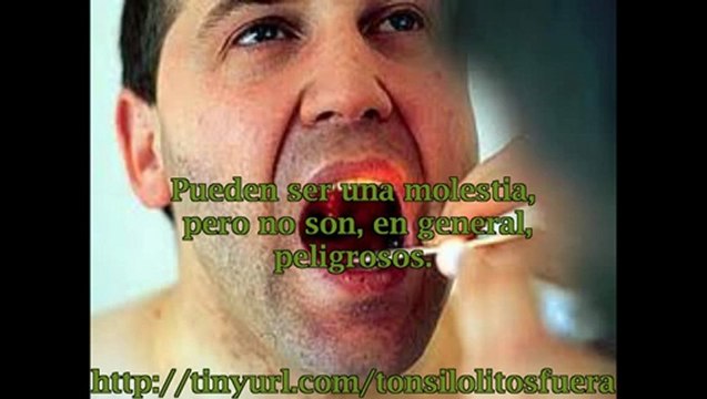 Calculos amigdalinos remedios naturales