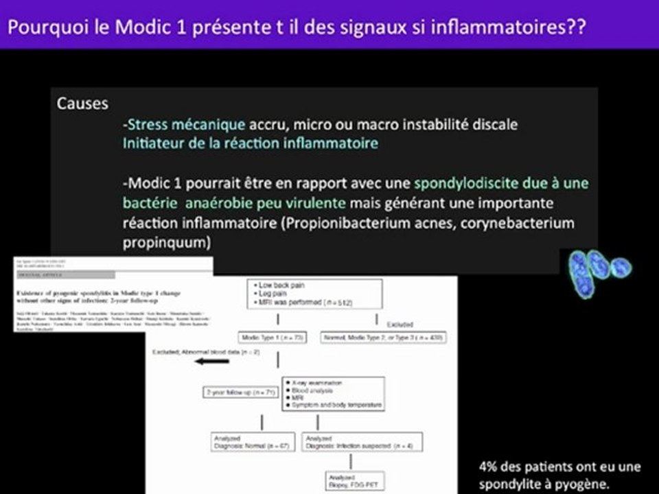 Spondylodiscite? Modic 1?