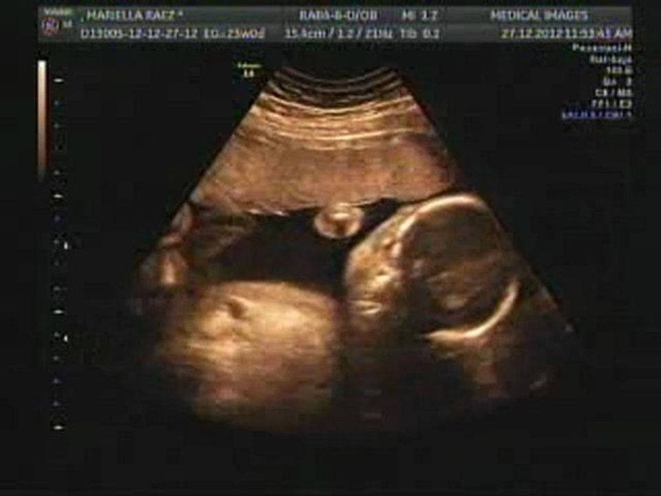 ecografia mariella flash