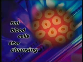 Miếng dán đào thải độc tố ra khỏi cơ thể (Không cần ăn or uống)