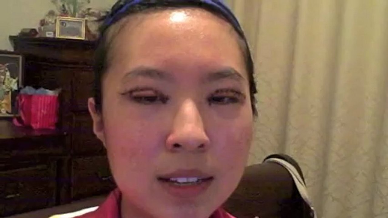 Asian Eyelid and Epicanthoplasty Video Diary