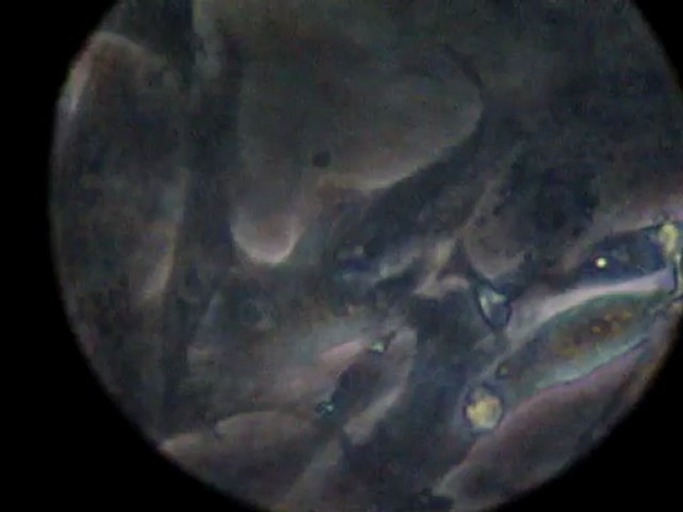 cardiomyocytes 3