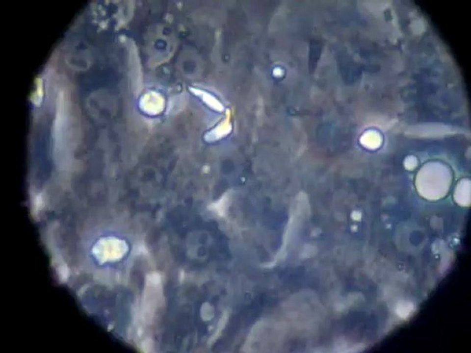 Cardiomyocytes