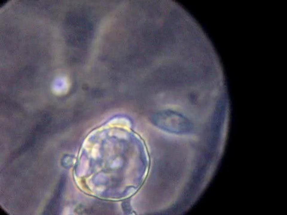 cardiomyocytes 2