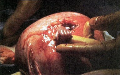 Baby reaches out from womb, holds doctor's finger