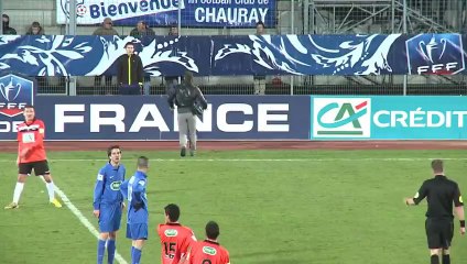 La honte devant 6600 personnes Stadier, pas un métier facile