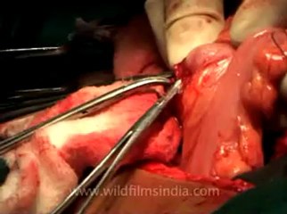 Medicine-mdv-478-13.flv