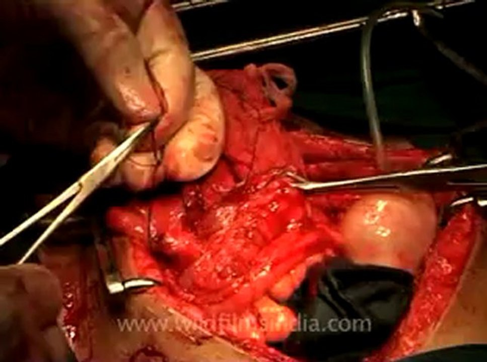 Medicine-mdv-478-21.flv