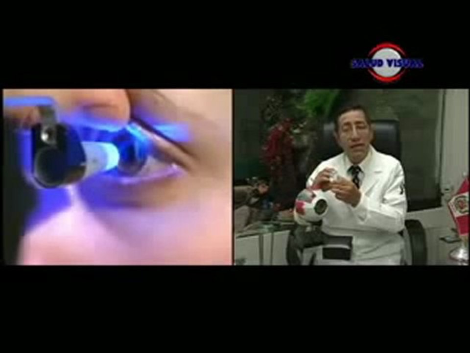 CIRUGIA LASER (EXCIMER LASER) EN SALUD VISUAL