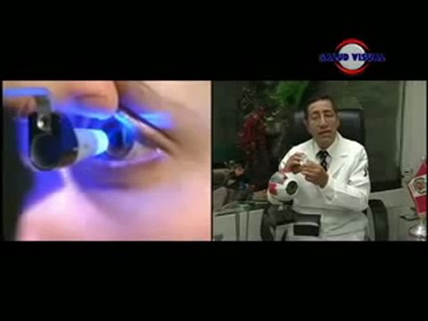 CIRUGIA LASER (EXCIMER LASER) EN SALUD VISUAL