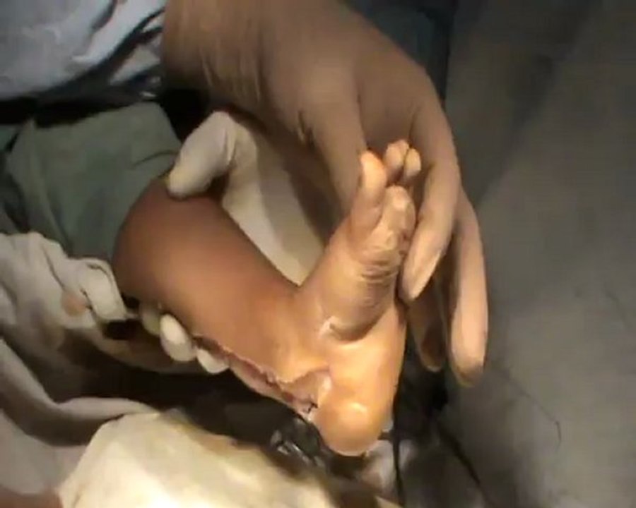 2-operation