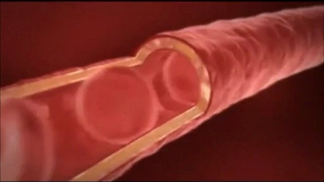 ALOE  VERA