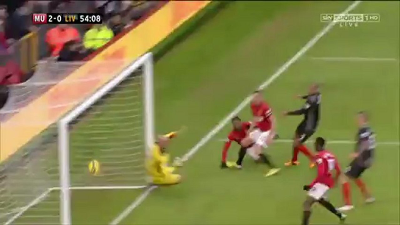 livVSmanu